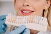 A dentist showing different shades for teeth whitening treatment