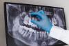 A doctor preparing for a Root Canal